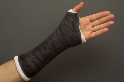 Distal Radius Fractures